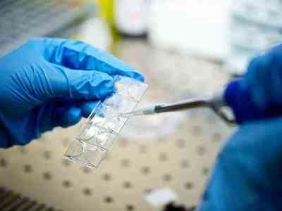 嘉运国际：基因编辑伦理边界探讨