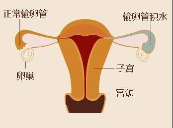 二胎/三胎政策放开，大龄夫妻如何备孕？嘉运国际有答案。