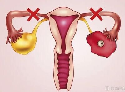 嘉运国际：三代试管为疑难病例提供新路径