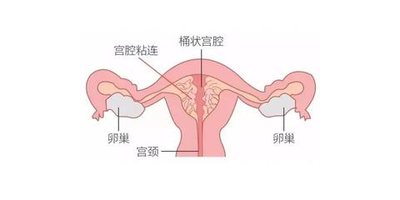 2026泰国三代试管婴儿成功率多少？怎么提高？