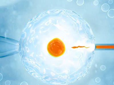 什么是不明原因不孕症适合试管婴儿助孕吗