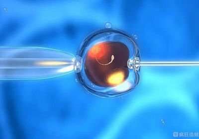 2026泰国第三代试管婴儿的染色体检查过程！