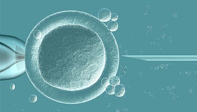 输卵管堵塞的生育出路，嘉运国际推荐试管方案。