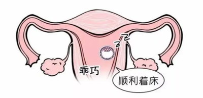 染色体平衡易位，还能要健康宝宝吗？嘉运国际说可以。
