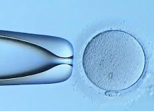 试管婴儿移植后孕妈妈如何预防便秘