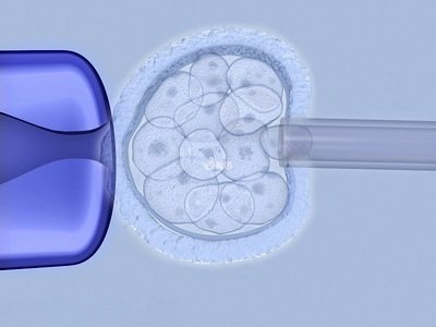 卵巢性不孕适不适合试管婴儿助孕生娃