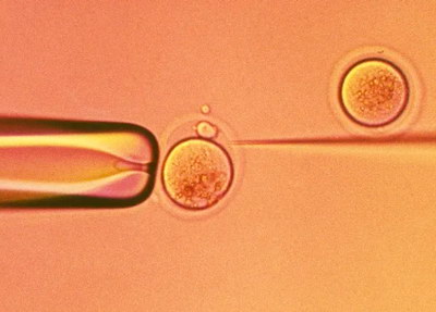 慢性盆腔炎为什么会不孕可以试管婴儿助孕吗