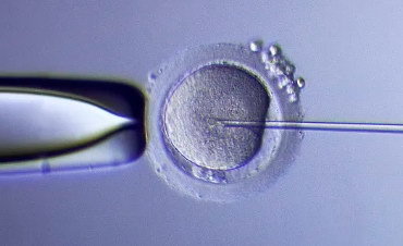 嘉运国际试管婴儿百科：您想知道的这里都有答案。