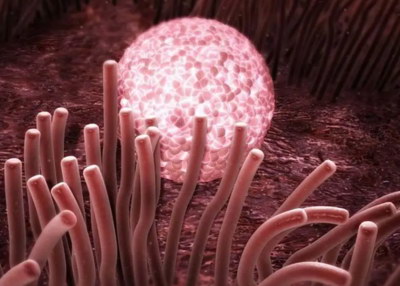 附睾炎发生哪些因素造成男性不育适合试管婴儿吗