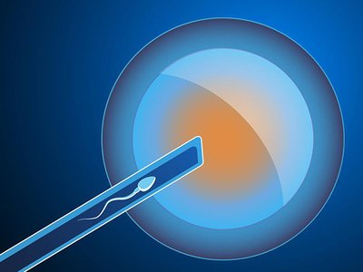 如何缓解试管过程中出现的紧张情绪