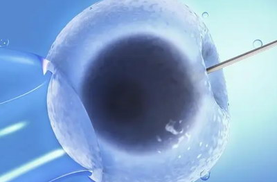 什么是卵巢性不孕?什么因素会导致这种情况的出现