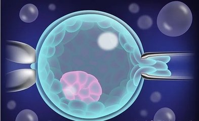 如何做才能增添试管婴儿胜利的机会