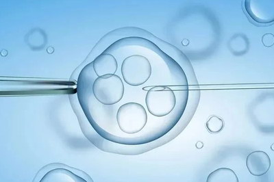 精索静脉曲张会导致不育吗能不能试管婴儿医治