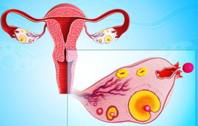 卵巢性不孕适不适合试管婴儿助孕生娃