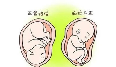 输卵管性不孕可以直接试管婴儿医治吗