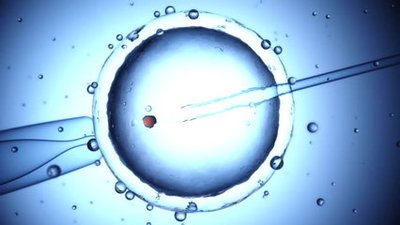 什么是卵巢早衰试管婴儿如何评估卵巢储备功用