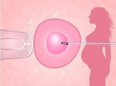 弓形子宫是什么,备孕之前如何养护子宫